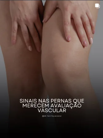 Sinais nas pernas que merecem avaliação
